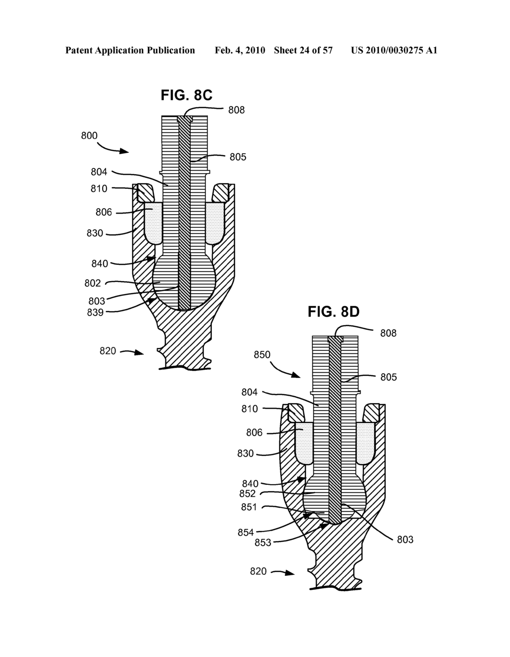 CONFIGURABLE DYNAMIC SPINAL ROD AND METHOD FOR DYNAMIC STABILIZATION OF THE SPINE - diagram, schematic, and image 25