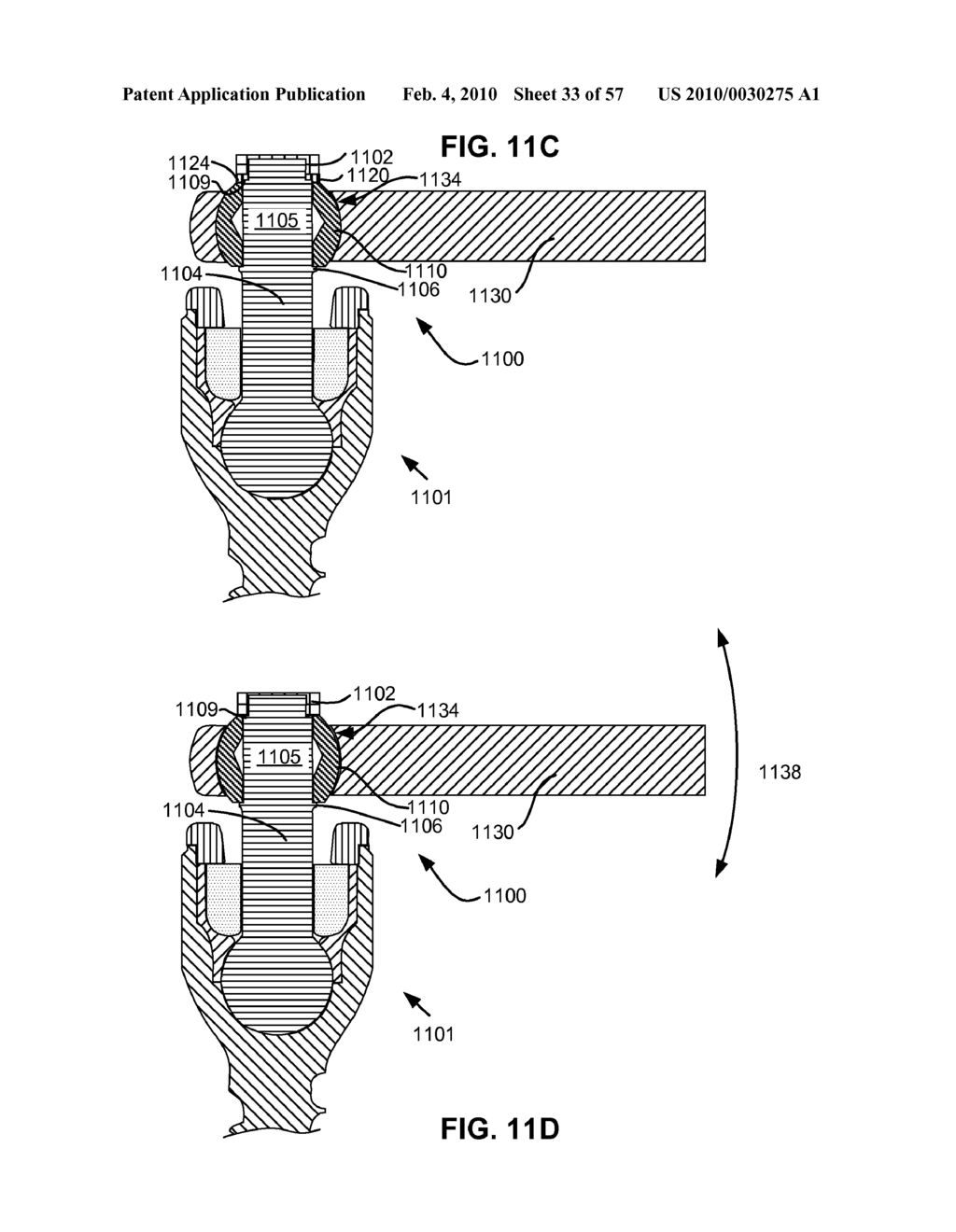 CONFIGURABLE DYNAMIC SPINAL ROD AND METHOD FOR DYNAMIC STABILIZATION OF THE SPINE - diagram, schematic, and image 34