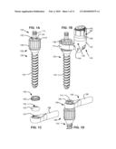 LOAD-SHARING BONE ANCHOR HAVING A DEFLECTABLE POST AND AXIAL SPRING AND METHOD FOR DYNAMIC STABILIZATION OF THE SPINE diagram and image