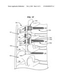 LOAD-SHARING BONE ANCHOR HAVING A DEFLECTABLE POST AND AXIAL SPRING AND METHOD FOR DYNAMIC STABILIZATION OF THE SPINE diagram and image