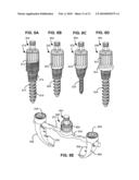 LOAD-SHARING BONE ANCHOR HAVING A DEFLECTABLE POST AND AXIAL SPRING AND METHOD FOR DYNAMIC STABILIZATION OF THE SPINE diagram and image