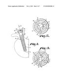 Upload shank swivel head bone screw spinal implant diagram and image