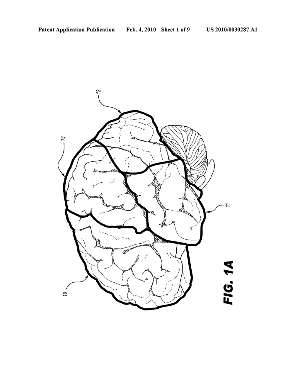 METHODS FOR TREATING AUTISM - diagram, schematic, and image 02