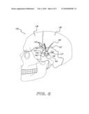 METHODS FOR TREATING AUTISM diagram and image