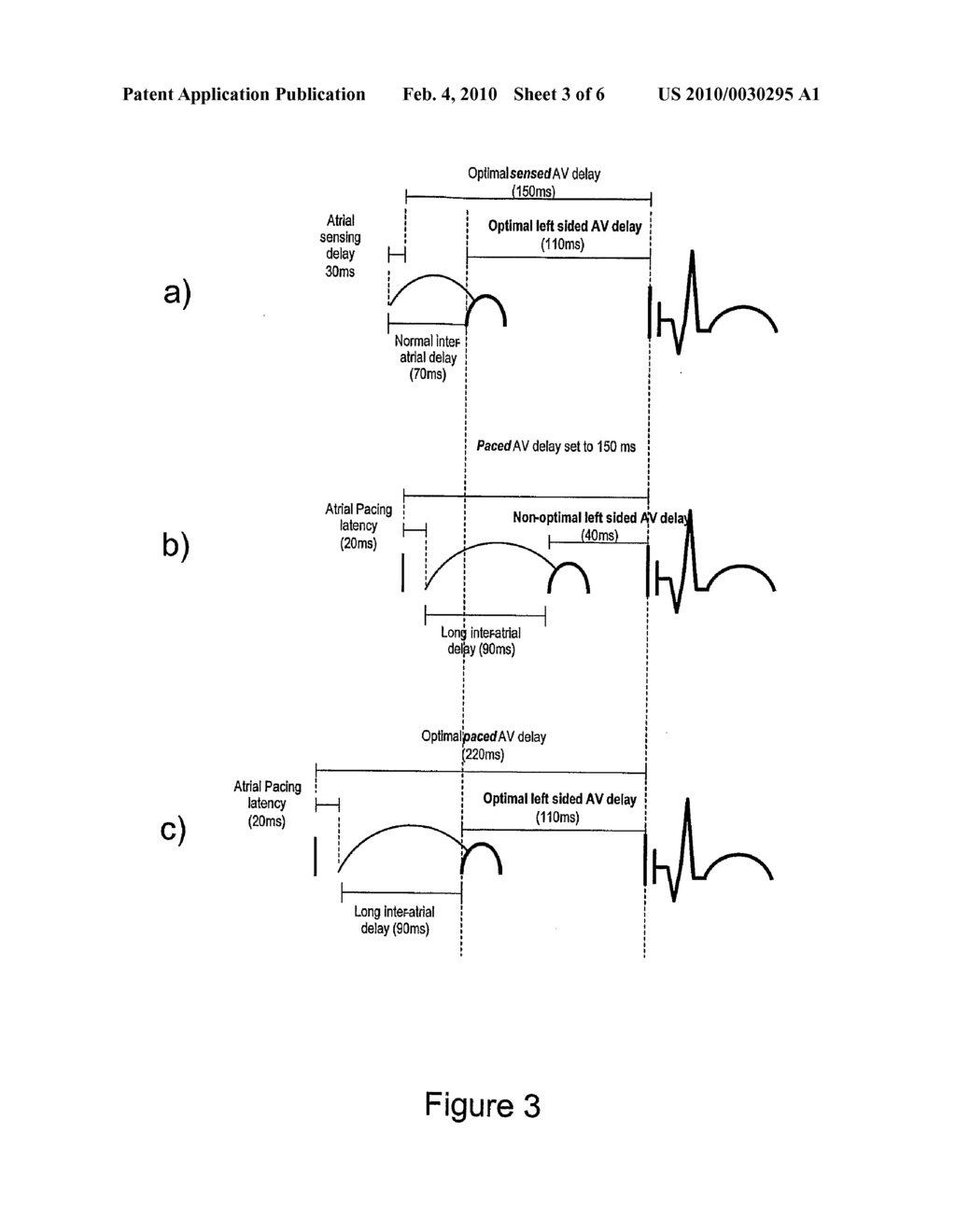 Apparatus and method for programming a pacemaker - diagram, schematic, and image 04