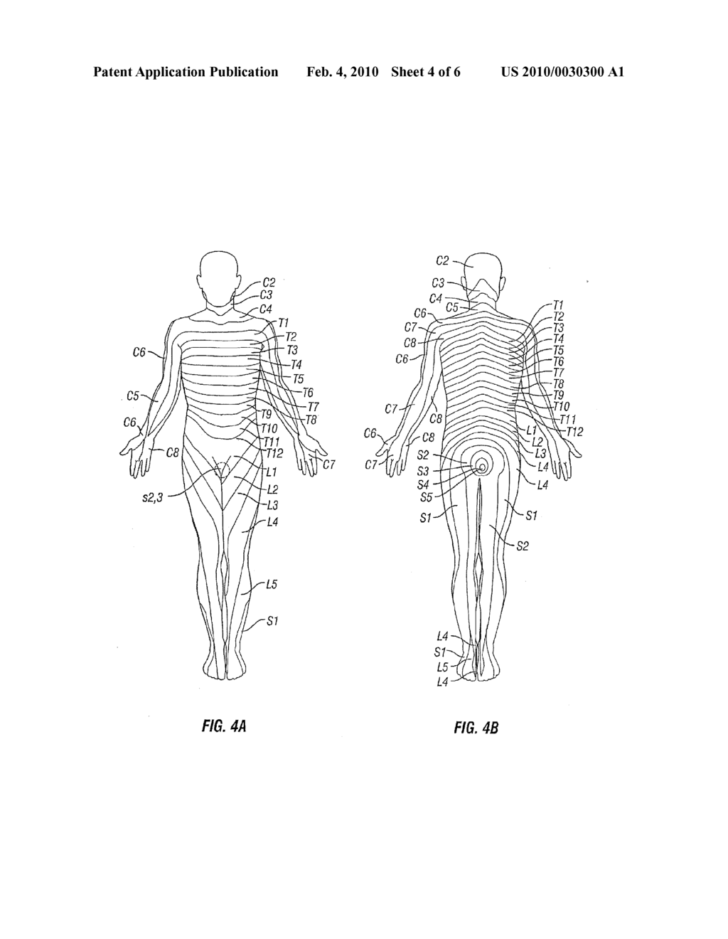 METHOD OF NEUROSTIMULATION OF DISTINCT NEURAL STRUCTURES USING SINGLE PADDLE LEAD TO TREAT MULTIPLE PAIN LOCATIONS AND MULTI-COLUMN, MULTI-ROW PADDLE LEAD FOR SUCH NEUROSTIMULATION - diagram, schematic, and image 05