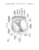 ELECTRICAL STIMULATION FOR MODULATION OF NEURAL PLASTICITY diagram and image