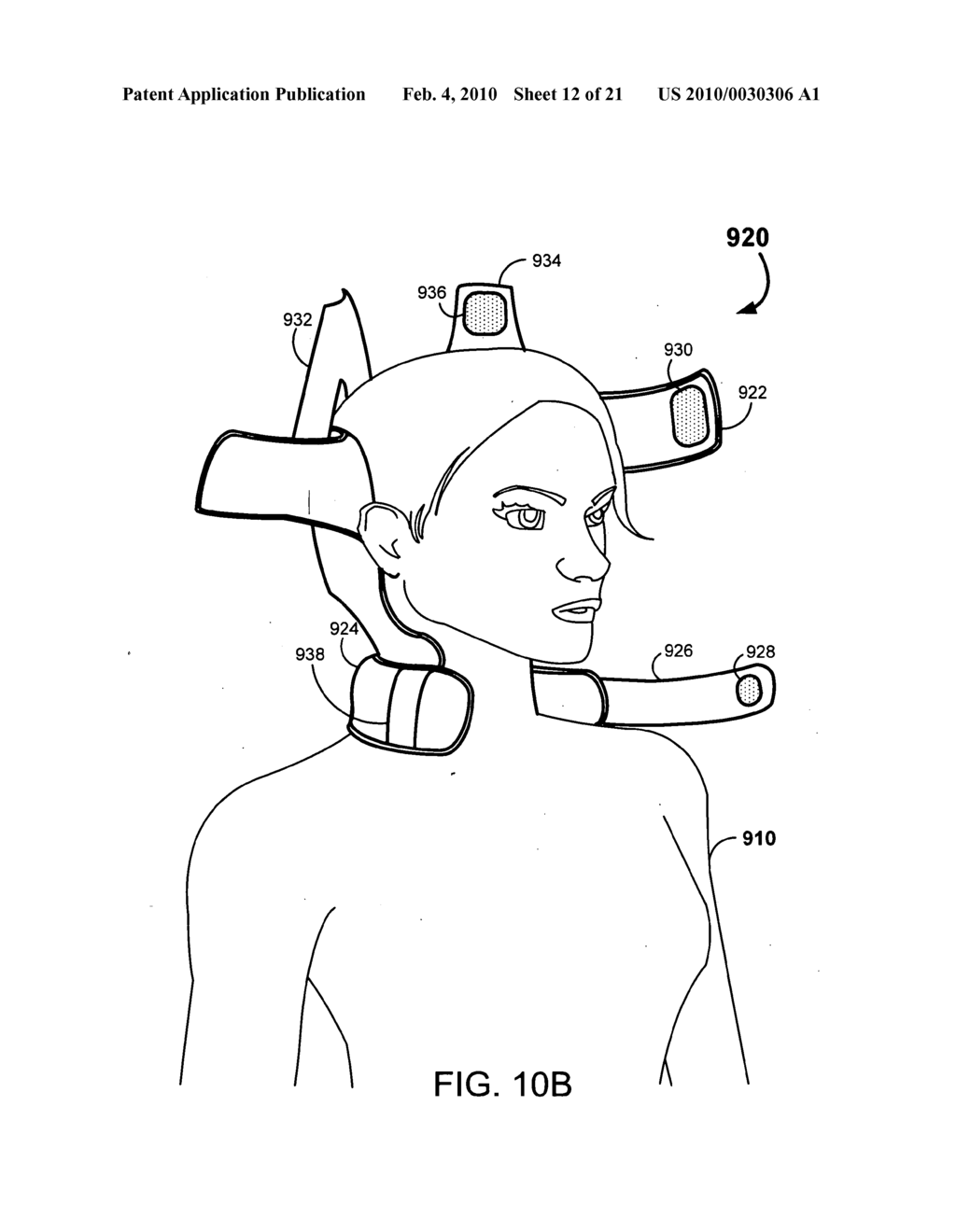 Therapeutic Cranial Wrap for a Contrast Therapy System - diagram, schematic, and image 13