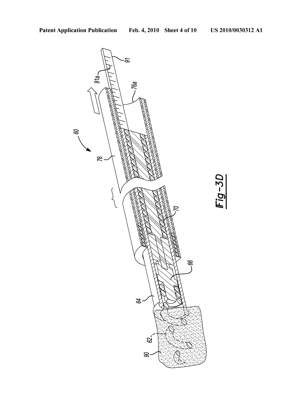 METHOD AND APPARATUS FOR LEAD LENGTH DETERMINATION - diagram, schematic, and image 05