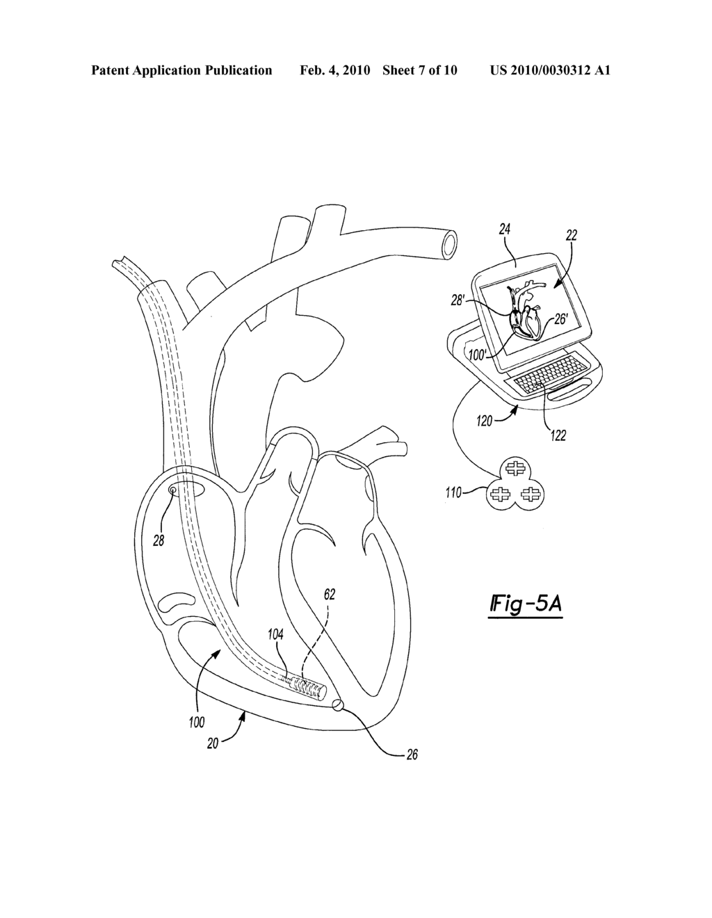 METHOD AND APPARATUS FOR LEAD LENGTH DETERMINATION - diagram, schematic, and image 08