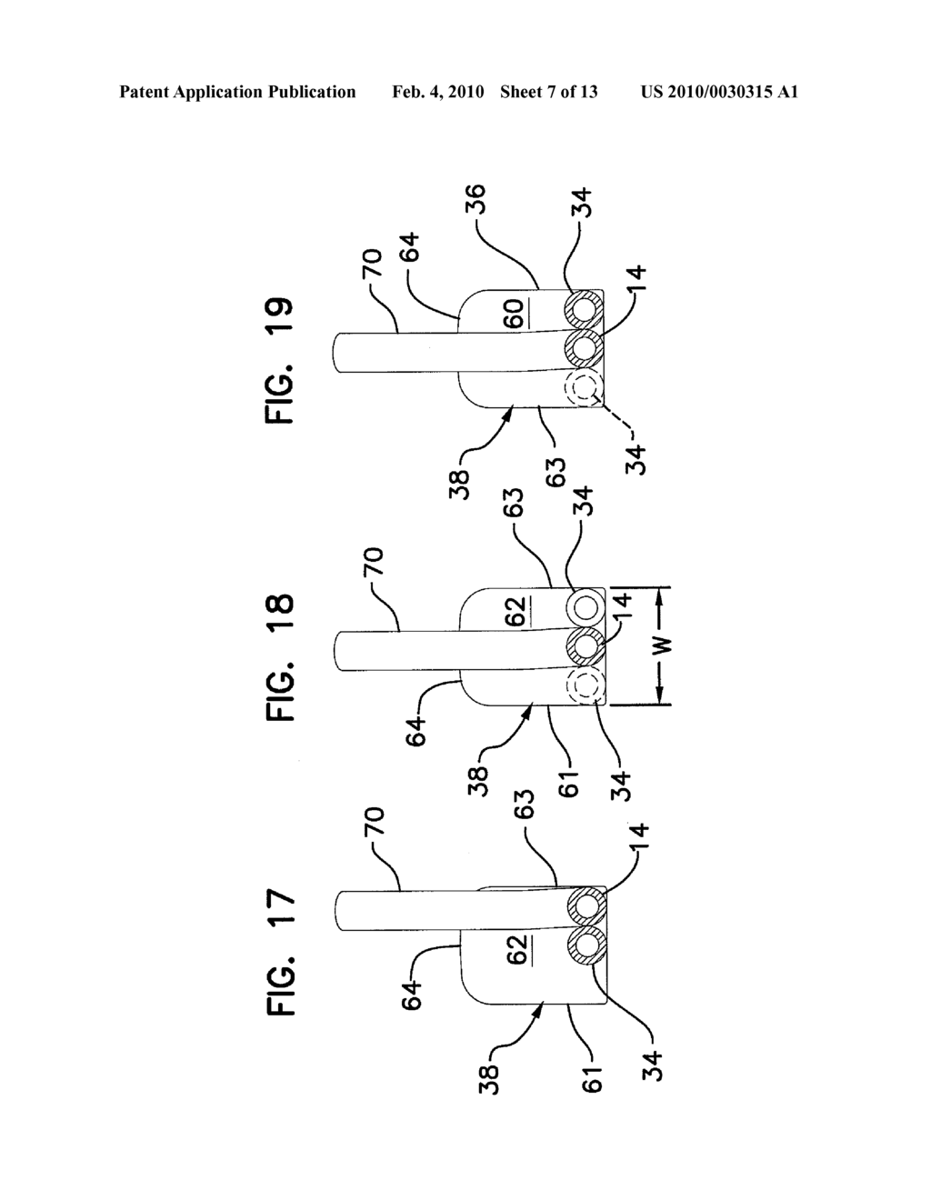 BIFURCATION CATHETER ASSEMBLY AND METHODS - diagram, schematic, and image 08