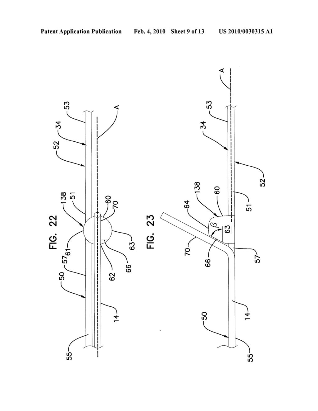 BIFURCATION CATHETER ASSEMBLY AND METHODS - diagram, schematic, and image 10