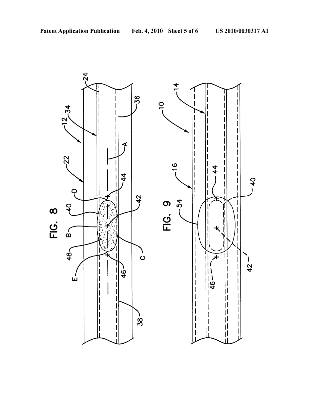 BIFURCATION CATHETER ASSEMBLY SIDE CATHETER BRANCH CONSTRUCTION AND METHODS - diagram, schematic, and image 06