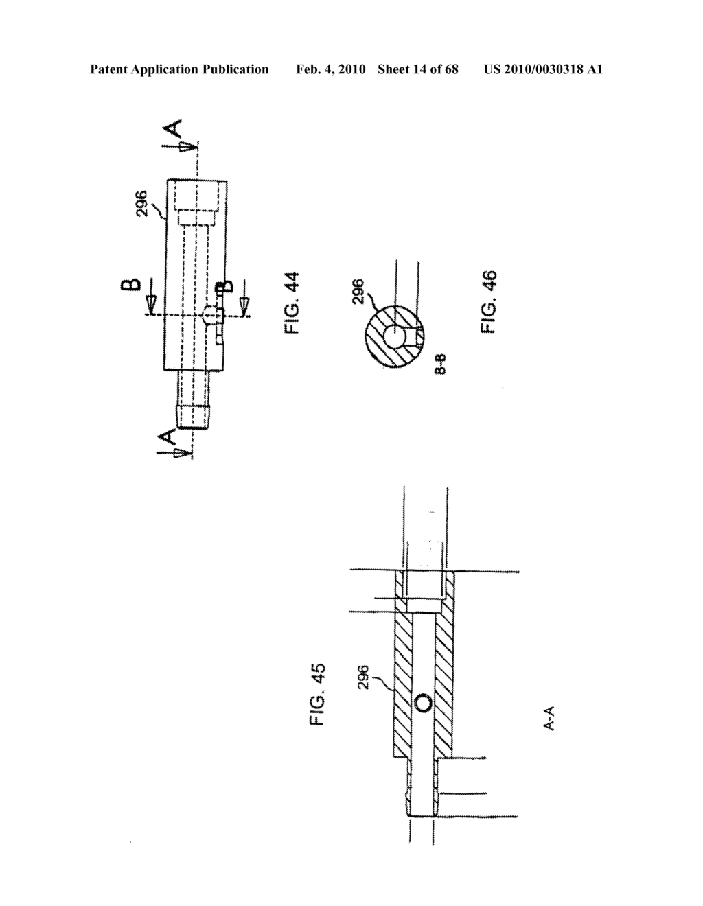 Dual Capture Device for Stent Graft Delivery System and Method for Capturing a Stent Graft - diagram, schematic, and image 15