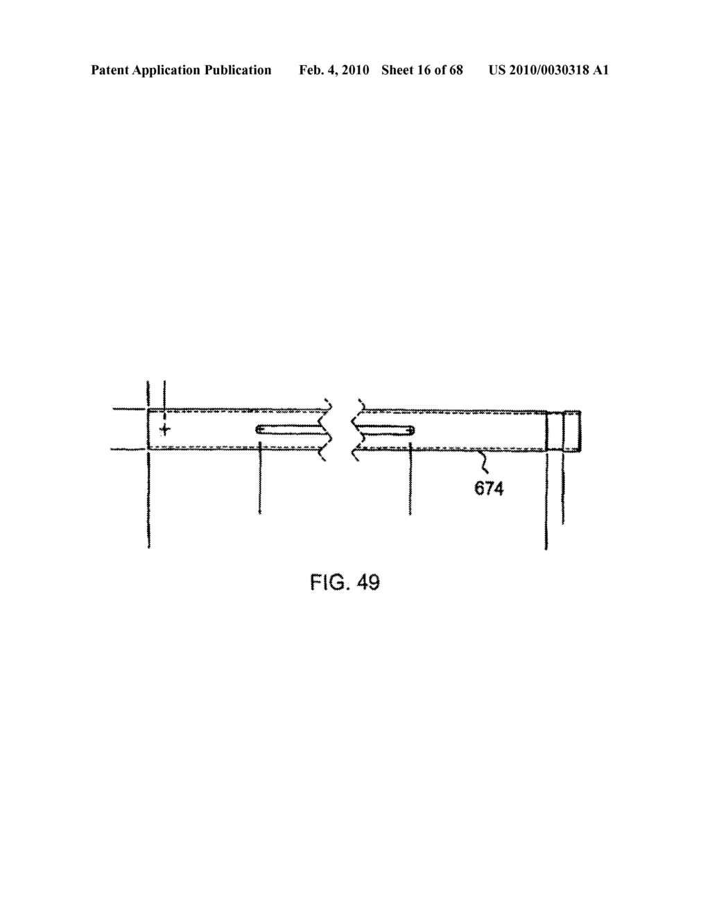 Dual Capture Device for Stent Graft Delivery System and Method for Capturing a Stent Graft - diagram, schematic, and image 17