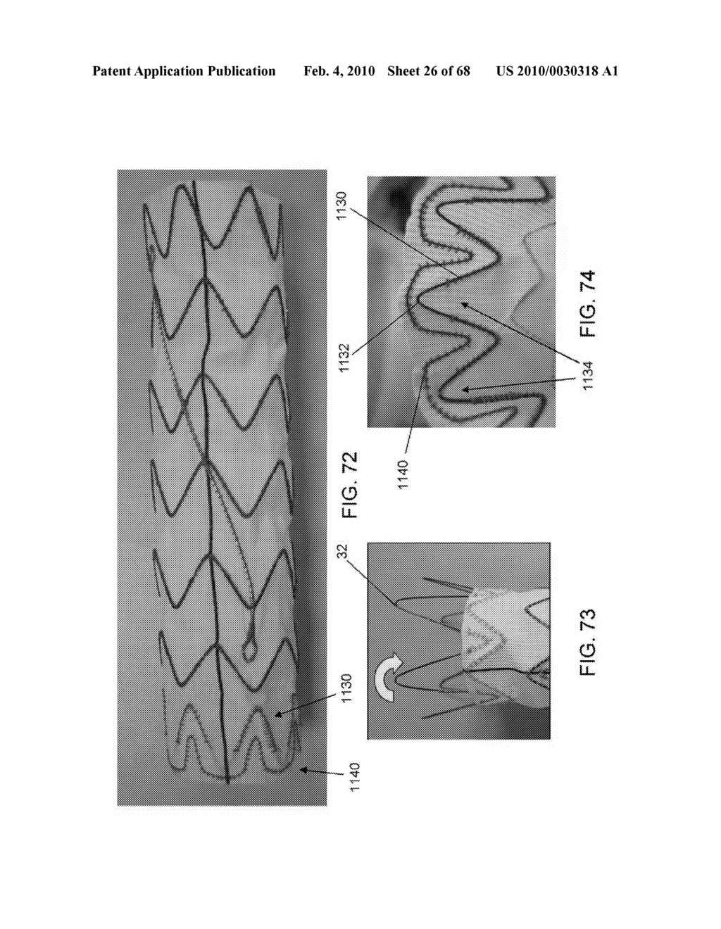 Dual Capture Device for Stent Graft Delivery System and Method for Capturing a Stent Graft - diagram, schematic, and image 27