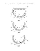 Annuloplasty Prosthesis diagram and image