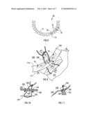 Annuloplasty Prosthesis diagram and image