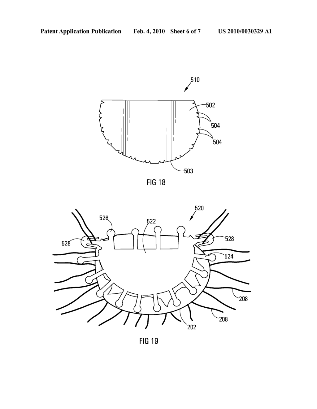 Annuloplasty Prosthesis - diagram, schematic, and image 07