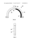 Annuloplasty Prosthesis diagram and image