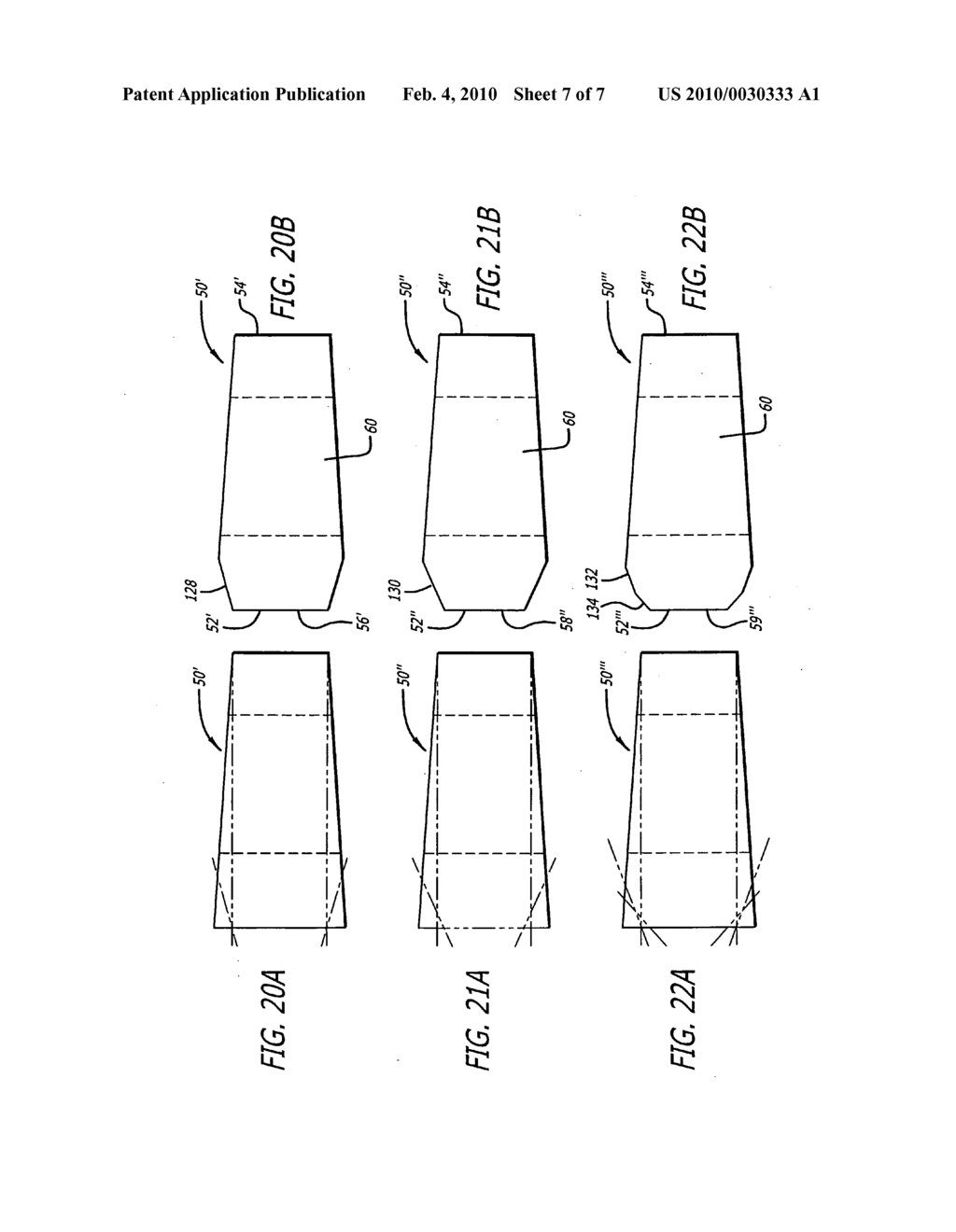 Hemi-interbody spinal fusion implants manufactured from a major long bone ring - diagram, schematic, and image 08