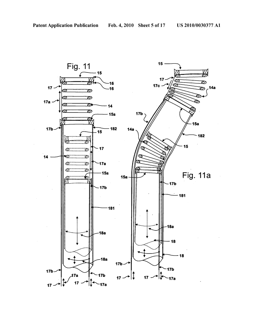 Snaking Robotic Arm with Movable Shapers - diagram, schematic, and image 06