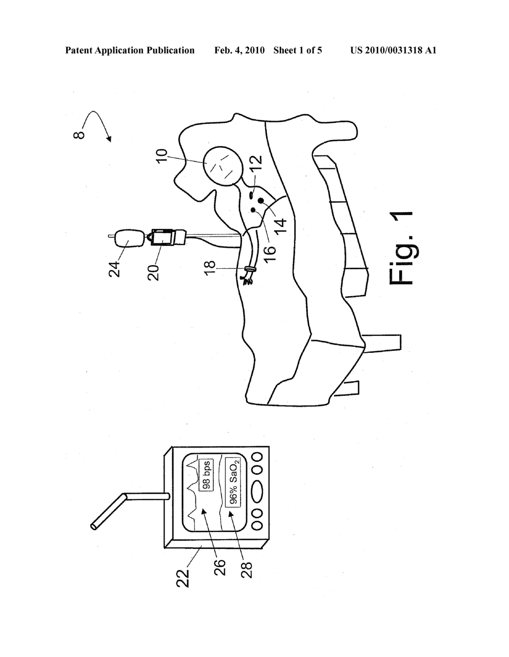 DISTRIBUTED DEVICE REVOCATION - diagram, schematic, and image 02