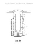 Method and Apparatus for Expanded Liner Extension Using Uphole Expansion diagram and image