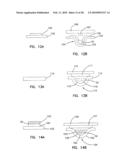 Small Volume In Vitro Sensor and Methods of Making diagram and image