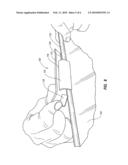 TRAY-TAG diagram and image