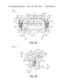 SYSTEMS AND METHODS FOR TETHERED WIND TURBINES diagram and image