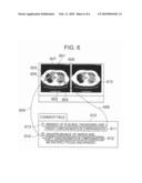 REPORT GENERATION SUPPORT APPARATUS, REPORT GENERATION SUPPORT SYSTEM, AND MEDICAL IMAGE REFERRING APPARATUS diagram and image