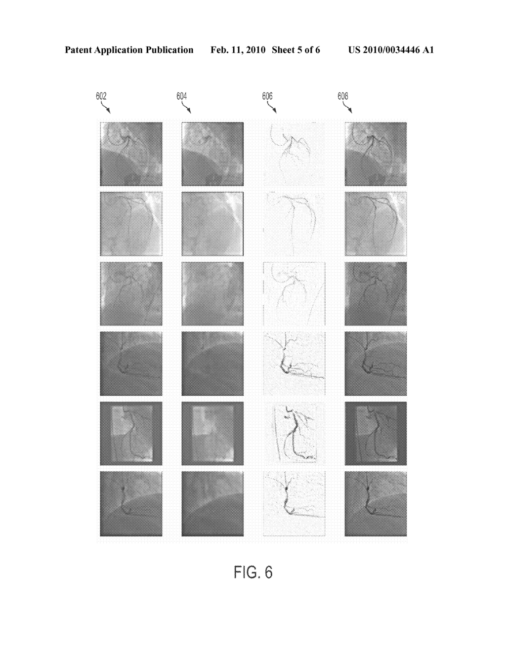 System and Method for Coronary Digital Subtraction Angiography - diagram, schematic, and image 06