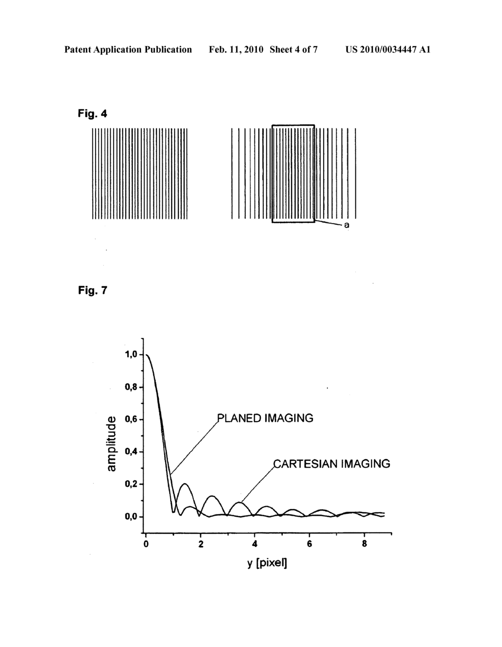 PARALLEL MRI INVOLVING DENSITY WEIGHTING OR ACQUISITION WEIGHTING - diagram, schematic, and image 05