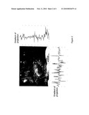 METHOD FOR SIGNAL CONDITIONING diagram and image