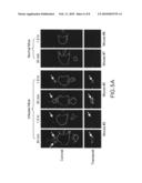 Fungus-Specific Imaging Agents diagram and image