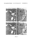 COMPOSITION AND METHODS FOR PROMOTING HAIR GROWTH diagram and image