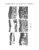 COMPOSITION AND METHODS FOR PROMOTING HAIR GROWTH diagram and image