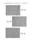 ENDOTHELIAL PROGENITOR CELL COMPOSITIONS AND NEOVASCULARIZATION diagram and image