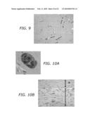 ENDOTHELIAL PROGENITOR CELL COMPOSITIONS AND NEOVASCULARIZATION diagram and image