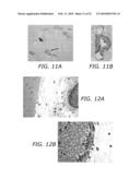 ENDOTHELIAL PROGENITOR CELL COMPOSITIONS AND NEOVASCULARIZATION diagram and image