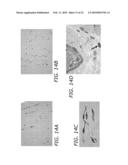 ENDOTHELIAL PROGENITOR CELL COMPOSITIONS AND NEOVASCULARIZATION diagram and image