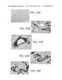 ENDOTHELIAL PROGENITOR CELL COMPOSITIONS AND NEOVASCULARIZATION diagram and image