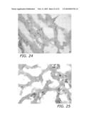 ENDOTHELIAL PROGENITOR CELL COMPOSITIONS AND NEOVASCULARIZATION diagram and image