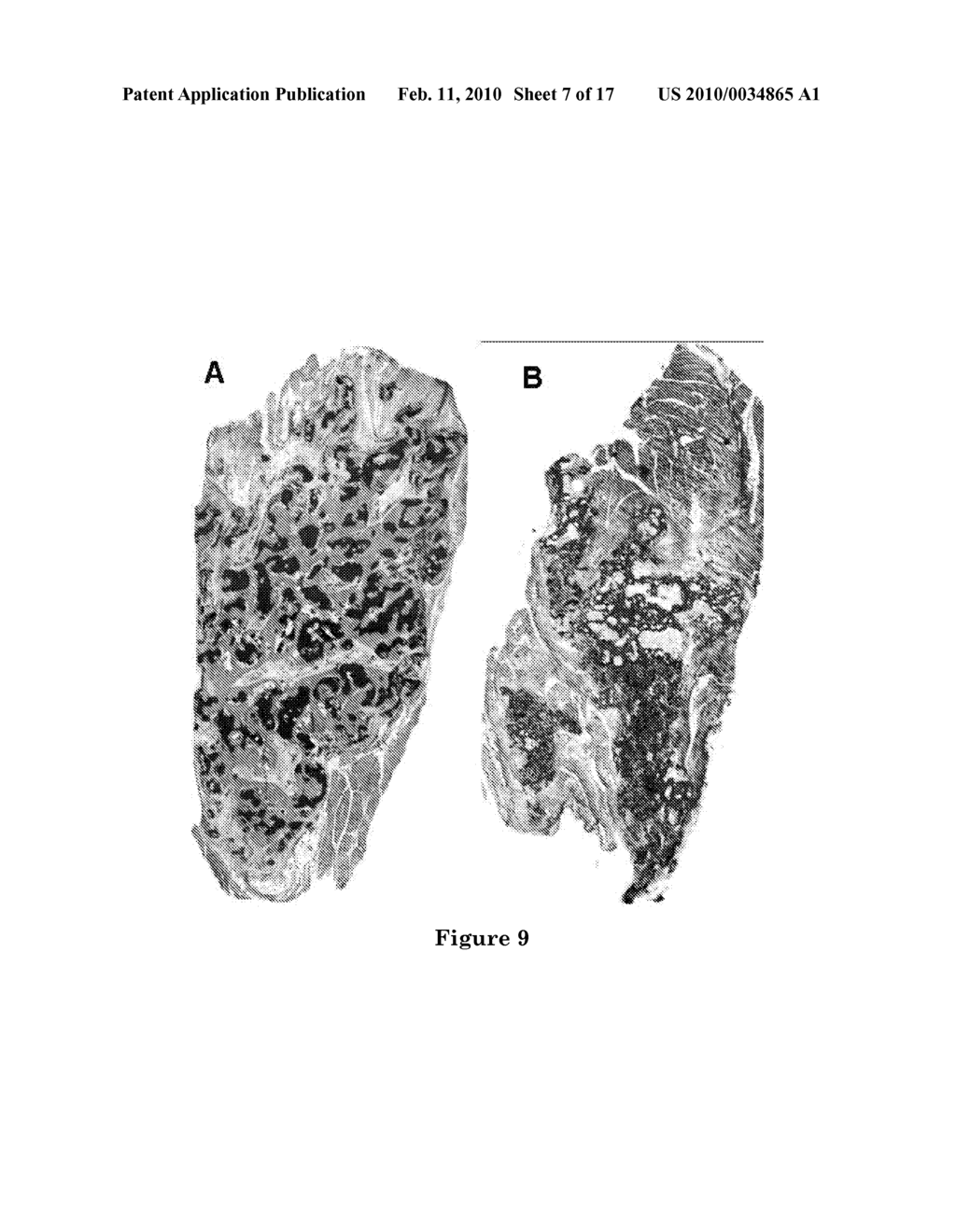 OSTEOINDUCTIVE CALCIUM PHOSPHATES - diagram, schematic, and image 08