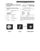 Fused stem cells useful for the treatment of diabetes and methods thereof diagram and image