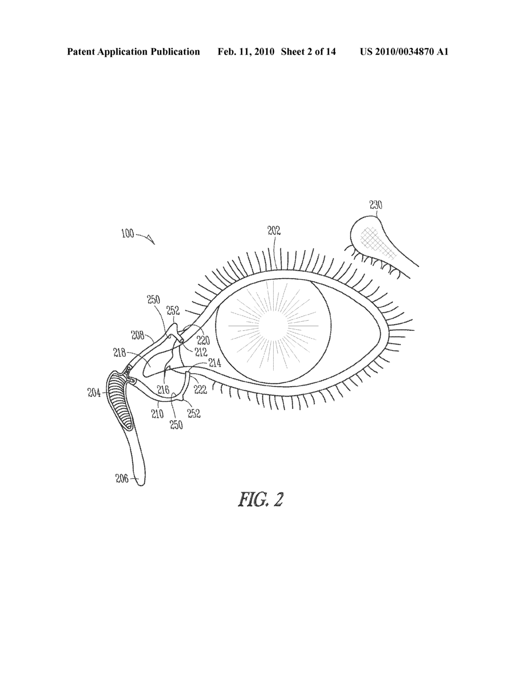 COMPOSITE LACRIMAL INSERT AND RELATED METHODS - diagram, schematic, and image 03