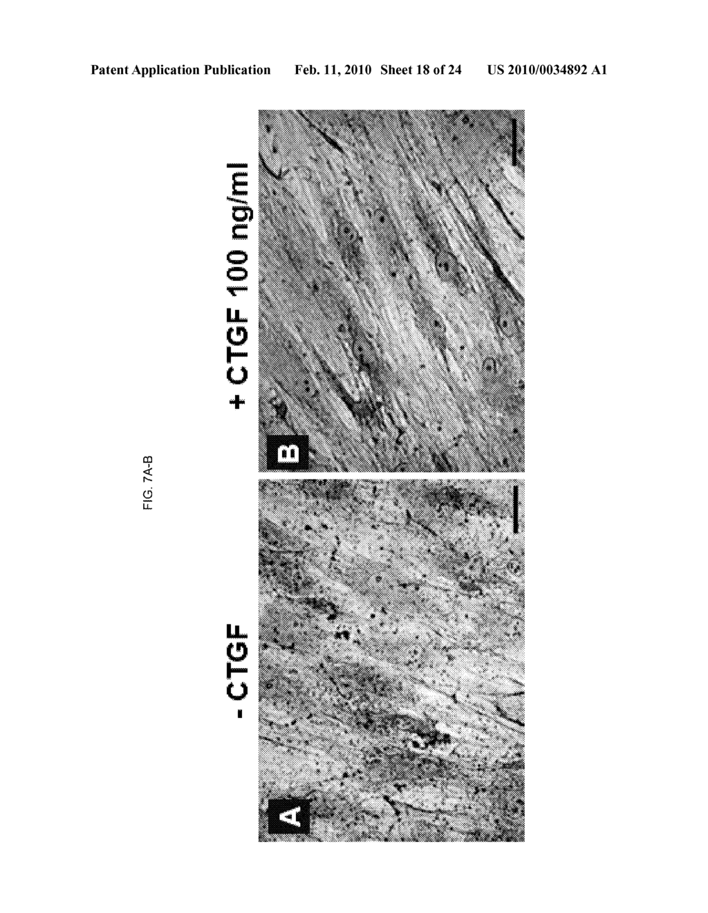 TREATMENT FOR BONE FORMATION DISORDERS BY GROWTH FACTOR DELIVERY - diagram, schematic, and image 19