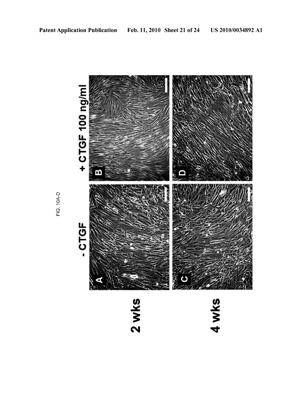 TREATMENT FOR BONE FORMATION DISORDERS BY GROWTH FACTOR DELIVERY - diagram, schematic, and image 22