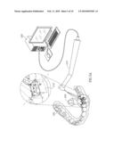 Universal Template Enabling Drilling and Placing a Dental Implant Into A Patient s Jaw diagram and image